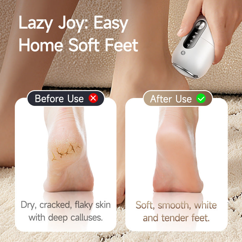 Electric Callus Remover